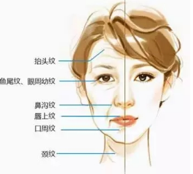 盐城眼部一旦出现了皱纹如何预防