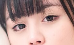 盐城双眼皮变内双怎么恢复