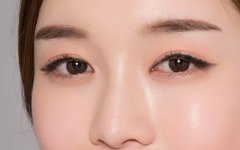 盐城开眼角整形手术是什么样的呢