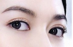 盐城埋线双眼皮的手术特点有哪些