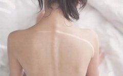 盐城为什么要进行背部吸脂
