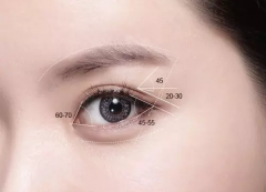 盐城双眼皮3个月可以修复吗