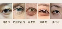 盐城怎么去黑眼圈和眼袋