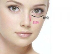 盐城手术切除眼袋后多久能上班？