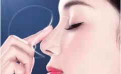 盐城歪鼻矫正手术疼吗