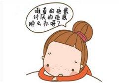 盐城激光祛疤痕有哪些副作用呢