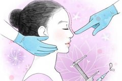鼻翼缩小盐城的步骤