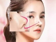 盐城鼻子不美怎么“型”