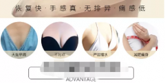 盐城乳晕过大