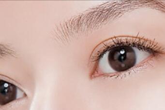 韩式双眼皮护理,韩式双眼皮